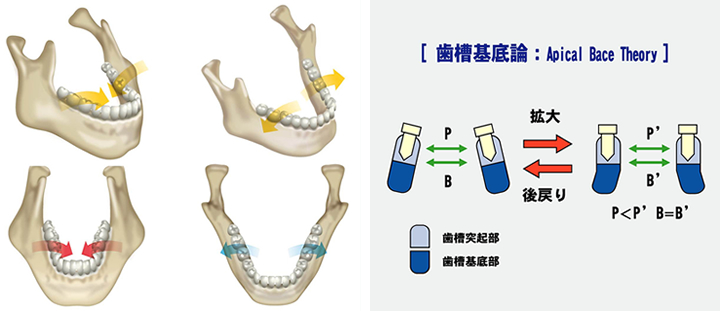 顎顔面口腔育成治療 - 長崎県松浦市の歯科 末竹歯科医院 Suetake Dental Clinic-｜モバイル